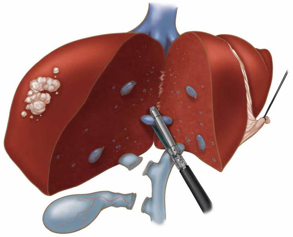 Hepatologist in Pune