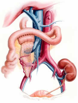 Kidney Pancreas Transplant