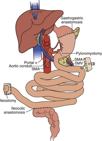 gastroenterologist in pune