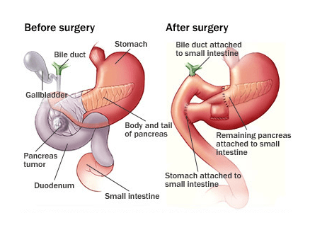 Hepatologist in Pune